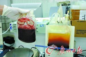 脐带血图片,生命的种子，医学的奇迹